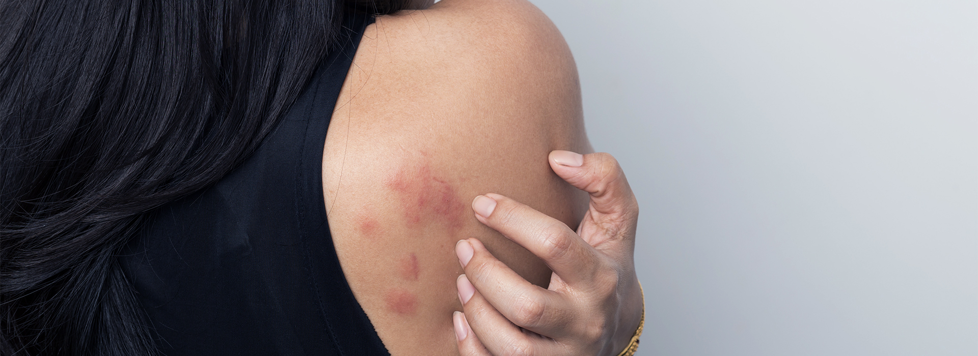 Skin Rashes And Growths Areas Of Care Sonoran Patients
