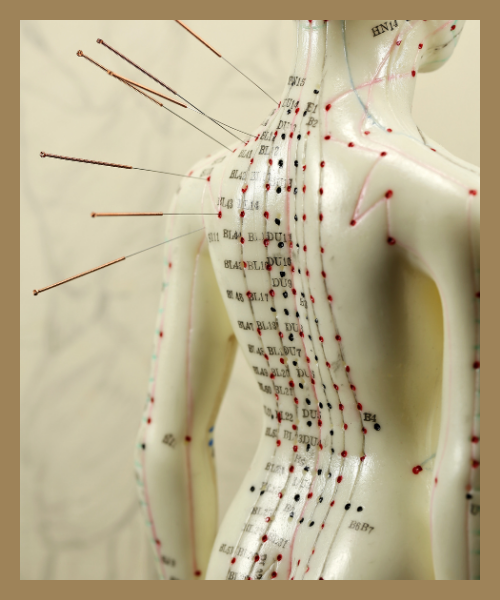 Model of an acupuncture doll with needles