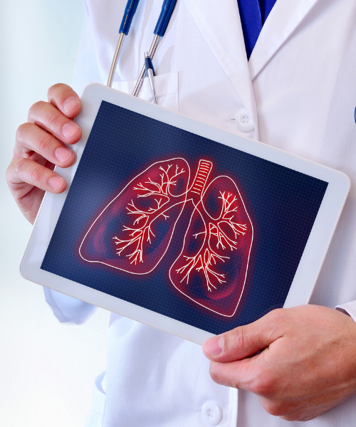 Doctor holding a tablet displaying a digital image of lungs. For a visual tip on respiratory health in high pollution.