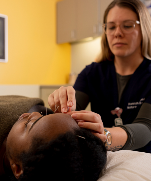 A healthcare professional performing acupuncture on a patient’s forehead, highlighting traditional Chinese medicine for holistic wellness.